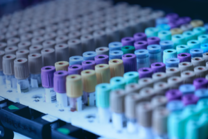 OCR enabled management software to automate stability testing